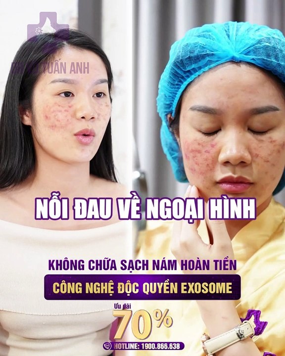#251 CĐ Review voice tự sự Hiền 21t-08.08- 67-H04