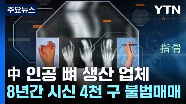 中 인공 뼈 생산 업체, 8년간 시신 4천 구 불법매매 / YTN