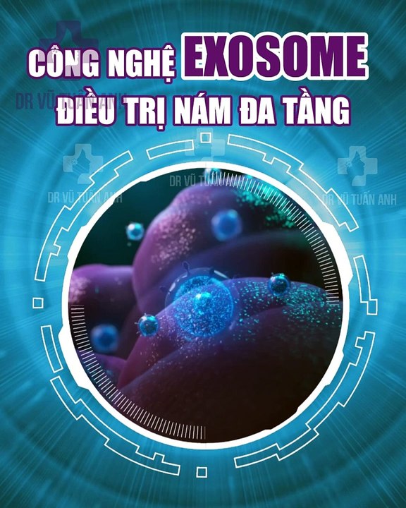 LỆ ADS 82023 - 10.08 - 86 - H04