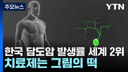 한국 담도암 발생률 세계 2위...치료제는 그림의 떡 / YTN
