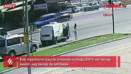 Saplantılı eski nişanlı kurbanı Elif'in sol bacağı kesildi!