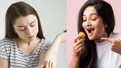 मीठा या खट्टा खाने से पित्ती उछलती है क्या | Urticaria Increase Reason & Treatment In Hindi|Boldsky