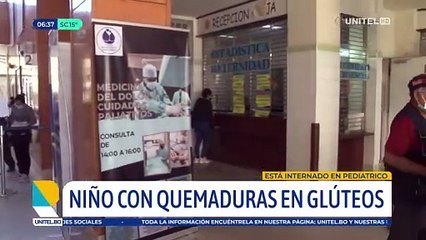 Niño que se quemó con ladrillo caliente fue derivado al Pediátrico de Cochabamba, la Defensoría investiga las circunstancias