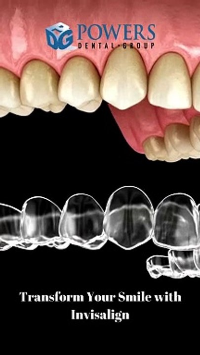 Transform Your Smile with Invisalign
