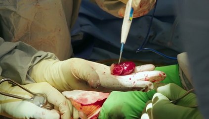Surgeons Life in Their Hands S01E01 (21 July 2024)