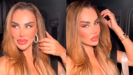 Ninel Conde es blanco de las criticas en Instagram por su drástico cambio en el rostro; ¡está irreconocible!