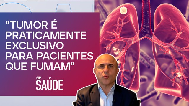Tumor de pequenas células corresponde a 30% dos casos de câncer de pulmão | Dr. Fernando Maluf