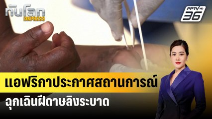 แอฟริกาประกาศสถานการณ์ฉุกเฉินฝีดาษลิงระบาด | ทันโลกEXPRESS | 14 ส.ค. 67
