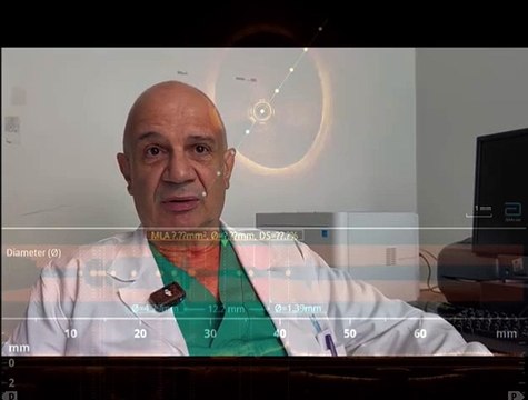 Grosseto, arterie cerebrali in tre dimensioni: nuovissima tecnica diagnostica