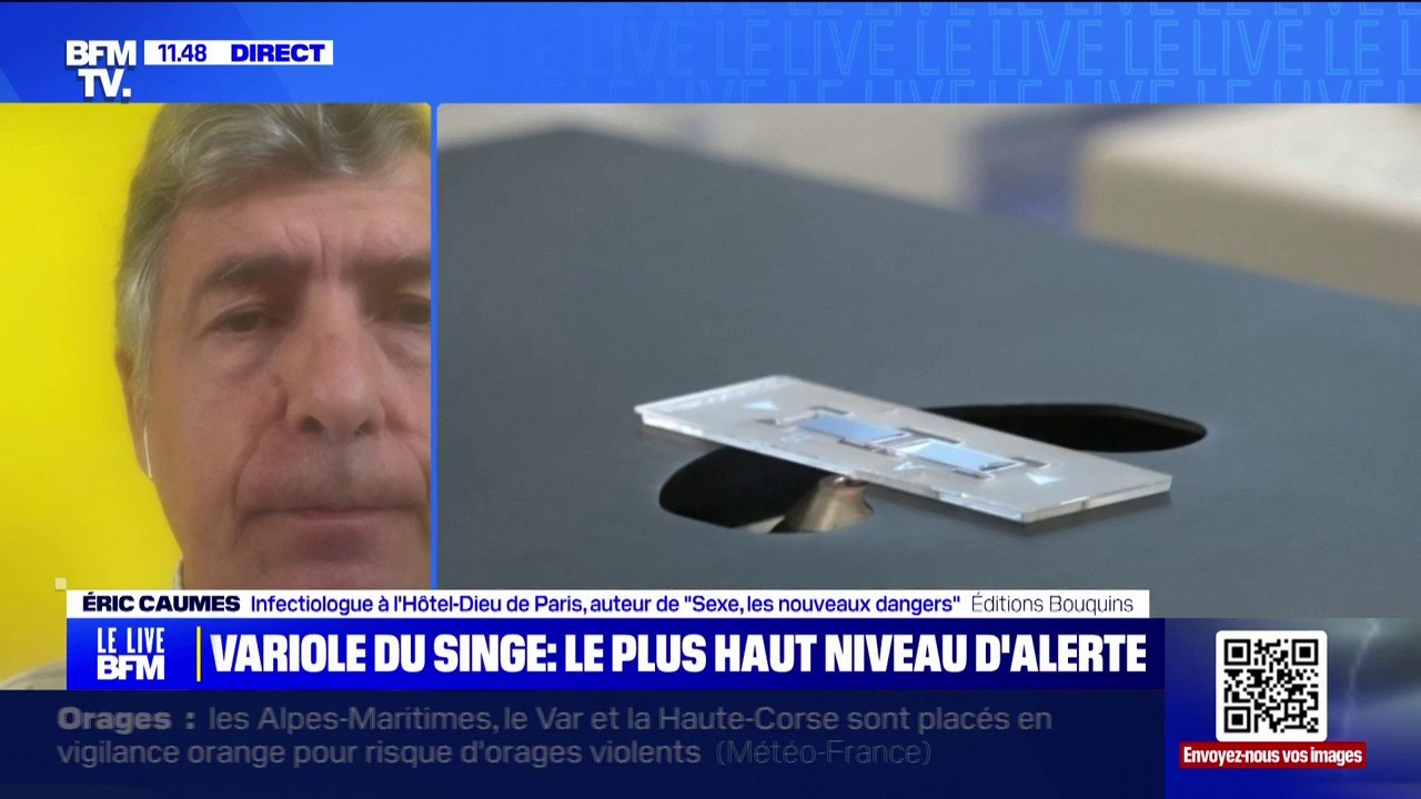 "Variole du singe": "Il ne faut pas compter sur un traitement mais il y a un vaccin", explique le professeur Éric Caumes, infectiologue à l'Hôtel-Dieu