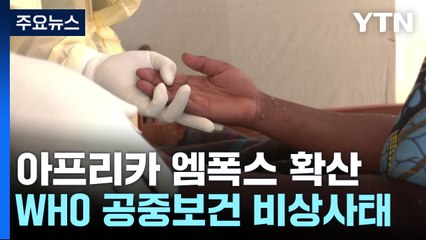 엠폭스 '공중보건 비상사태' 재선언..."확산 우려" / YTN