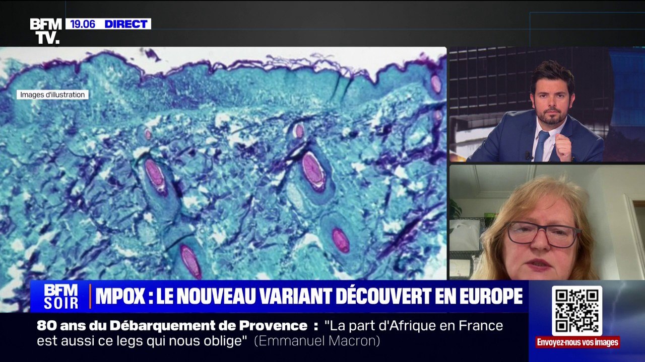 Rosamund Lewis (responsable technique à l'OMS pour la variole du singe): "Les autorités sanitaires européennes doivent augmenter la vigilance (...) Pour la population générale, le risque reste très bas"