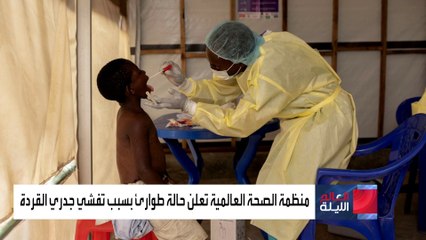 ماذا يعني إعلان "الصحة العالمية" حالة الطوارئ وكيف تتخذ القرار؟