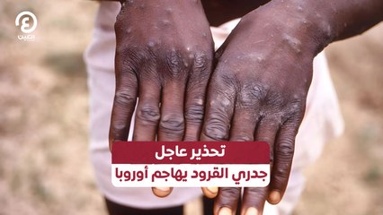 تحذير عاجل جدري القرود يهاجم أوروبا