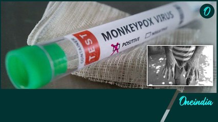 Monkey Pox.. పెరుగుతున్న మంకీ పాక్స్ కేసులు.. ఈ లక్షణాలు ఉంటే జాగ్రత్త | Oneindia Telugu