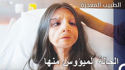 تريد الفتاة المريضة إخفاء وجهها عن الجميع - الطبيب المعجزة