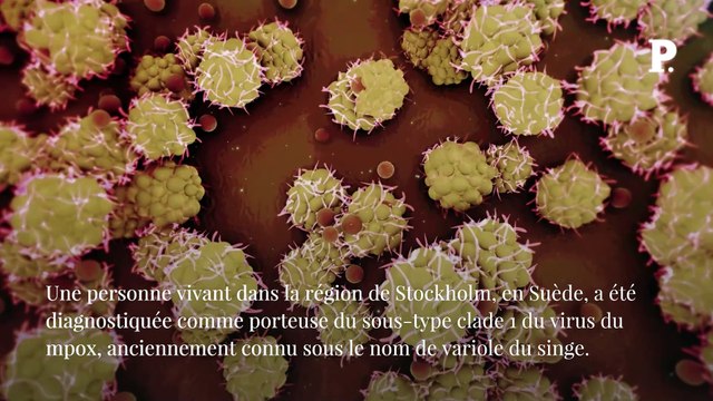 Mpox : l’OMS alerte sur le risque de cas importés en Europe ces « prochains jours »