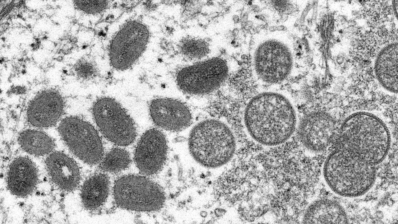 Wie gefährlich ist das Mpox-Virus?