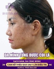 #287 Voice khách thật - 1608 - 137 - H04