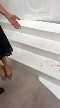 DEM Parti Grup Başkan Vekili Gülistan Kılıç Koçyiğit’in kaşı açıldı