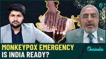 Monkeypox Virus: New Pandemic Threat in India or Just Panic? Dr. Ishwar Gilada Speaks—Exclusive Chat