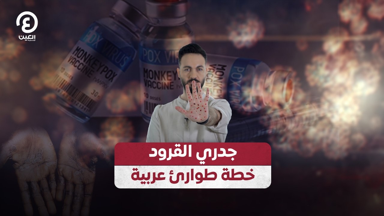 جدري القرود.. خطة طوارئ عربية