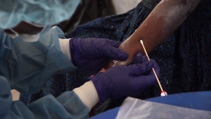 "엠폭스 대응 실패하면 아프리카 넘어 지구촌 전체 위험" / YTN