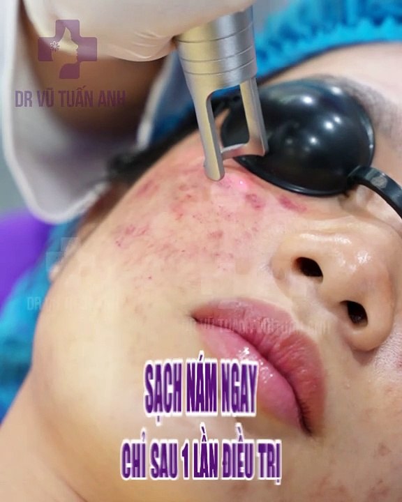 #CĐ_C Hiền 21T - 17.08 - 142 - H04