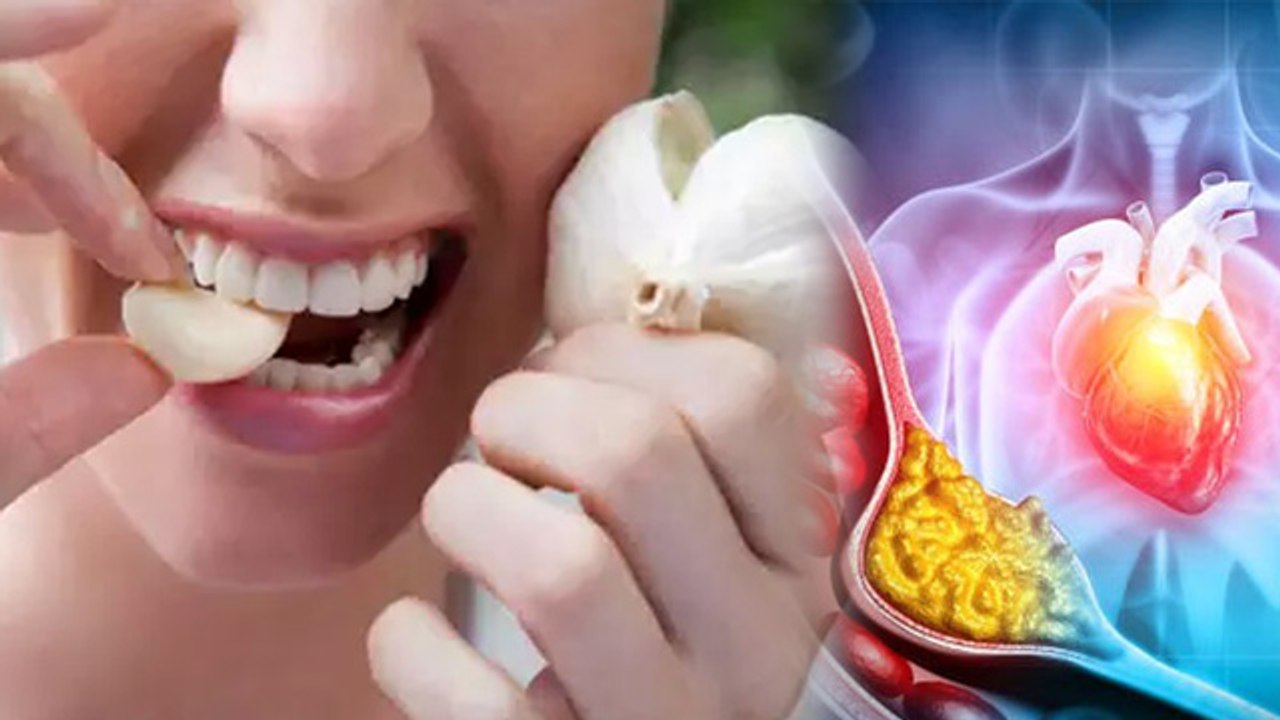 Cholesterol Me Lahsun Khane Se Kya Hota Hai | Is Garlic Good For High Cholesterol | Boldsky