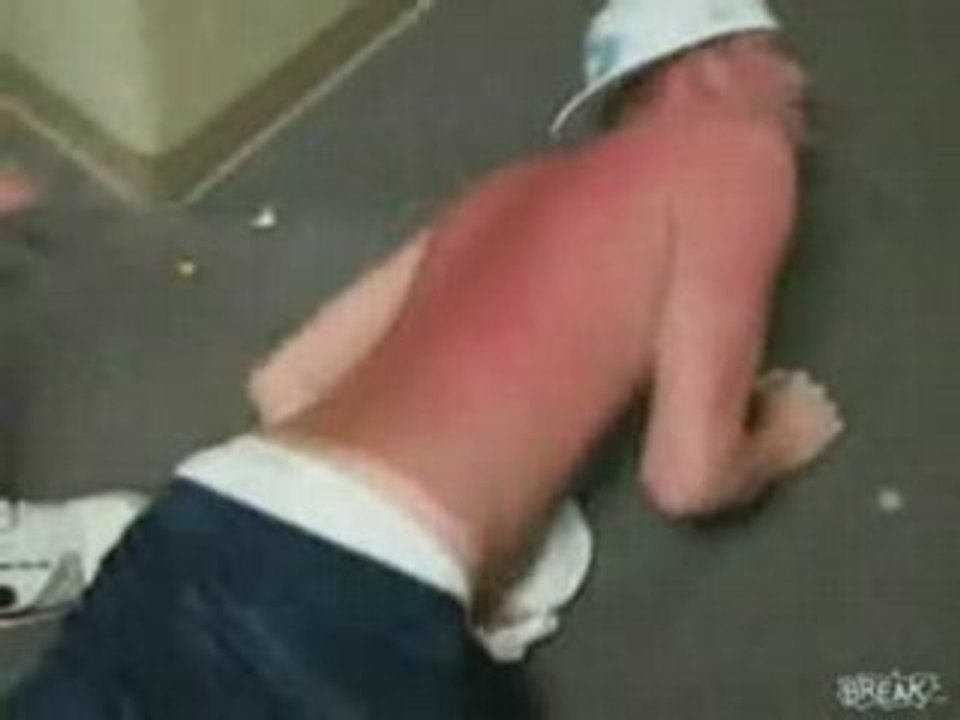 Sunburn Slap