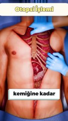 Otopsi işlemi nasıl ve ne için yapılır?