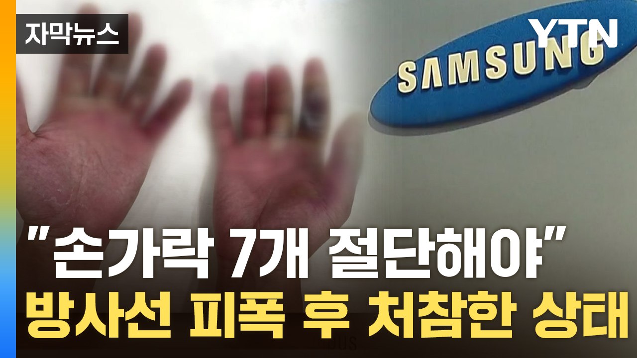 [자막뉴스] 삼성전자 피폭 직원, 손 공개..."뼈가 못 버텨 손가락 절단 위기" /...