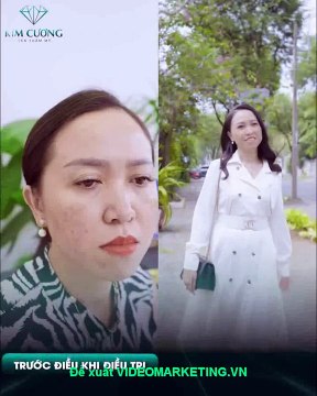 Sau 3 tháng điều trị thẩm mỹ