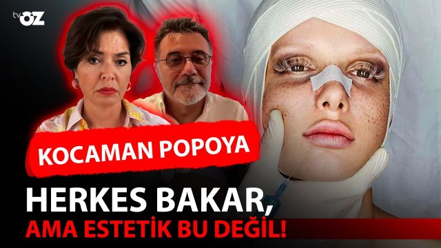 KOCAMAN POPOYA HERKES BAKAR, AMA ESTETİK BU DEĞİL !