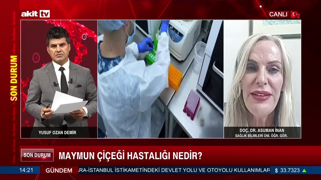 Maymun Çiçeği hastalığı nedir?