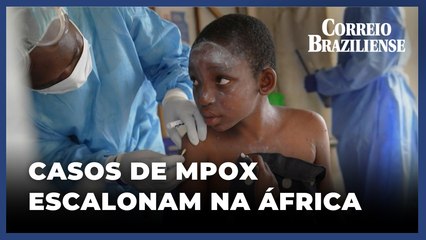 MPOX: África registra mais de 18 mil casos desde o início do ano