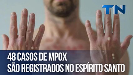 48 casos de Mpox são registrados no Espírito Santo