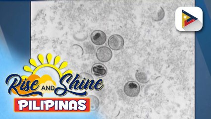 Tải video: Bagong kaso ng mpox sa bansa, kinumpirma ng DOH; Surveillance, detection, at contact tracing, pinaigting