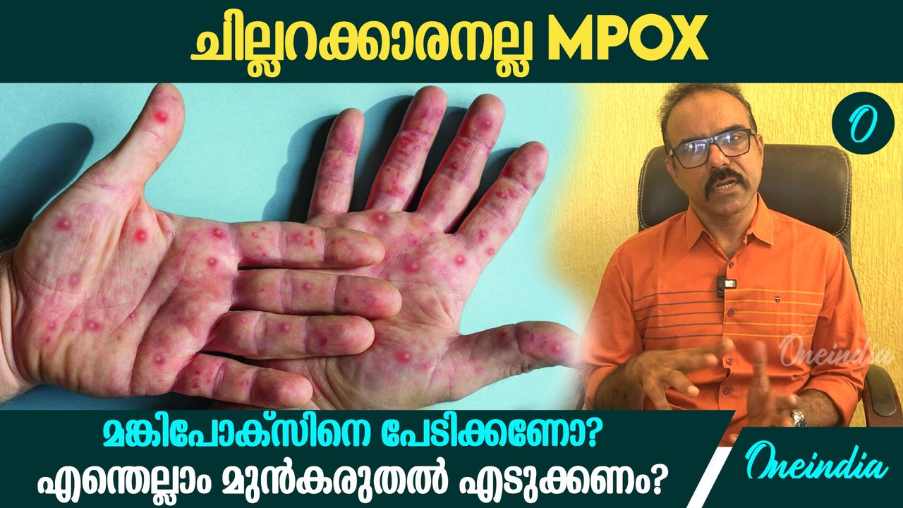 Mpoxനെ പേടിക്കണോ? ലക്ഷണങ്ങളെന്തെല്ലാം? പകരുന്നതെങ്ങനെ?| Mpox Infection, Symptoms And Prevention