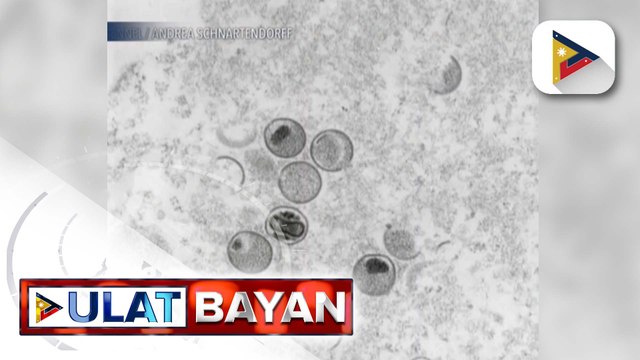 Ilang mambabatas, nanawagan ng mas pinaigting na pagtugon sa mpox