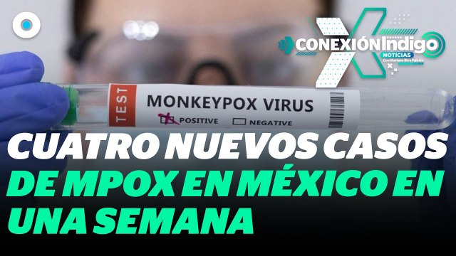 Aumentan a 53 los casos de Mpox en México; CDMX encabeza lista de contagios | Reporte Indigo