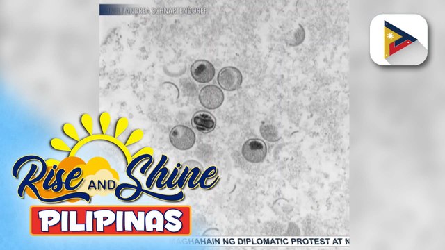 Mas pinaigting na pagtugon laban sa mpox, ipinanawagan ng ilang mambabatas
