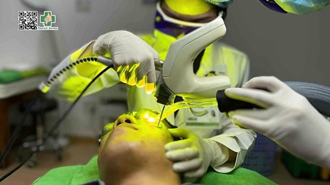 Trị mụn bằng laser: lợi ích, quy trình và giá điều trị