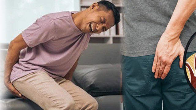 Kin Logo Ko Bawasir Ka Khatra Jada Hota Hai| Piles Causes Symptoms & Treatment In Hindi |Boldsky