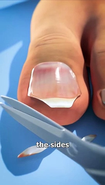 Don't Cut Your Toenails Like This ✂️ Do You Have A Long Second Toe.  #USA #Canada #Viral #Famous #trending #UniqueVideo #Viralclips #germany