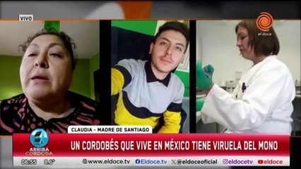 Un cordobés está grave en México por la viruela del mono y su mamá sostiene un pedido de asistencia económica