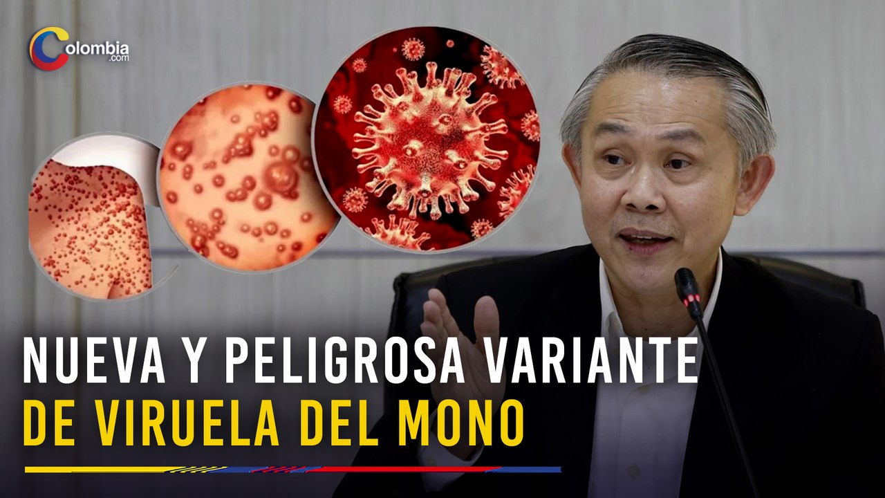 Tailandia reporta primer caso de variante más contagiosa y mortal del Mpox