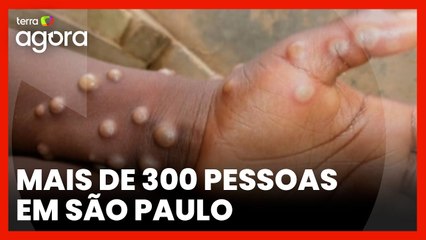 MPOX: Saiba mais sobre a doença que está se espalhando pelo Brasil