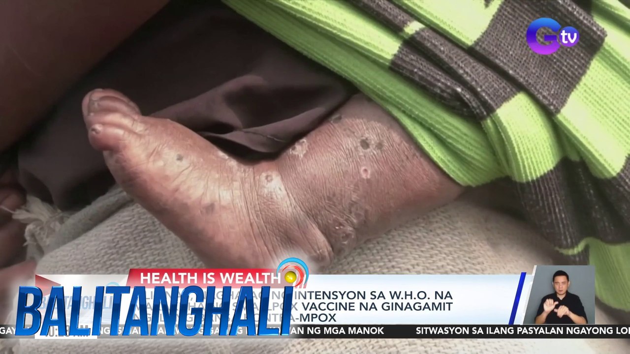 Pilipinas, naghayag ng intensyon sa W.H.O. na makakuha ng smallpox vaccine na ginagamit ng ilang bansa kontra-mpox | Balitanghali