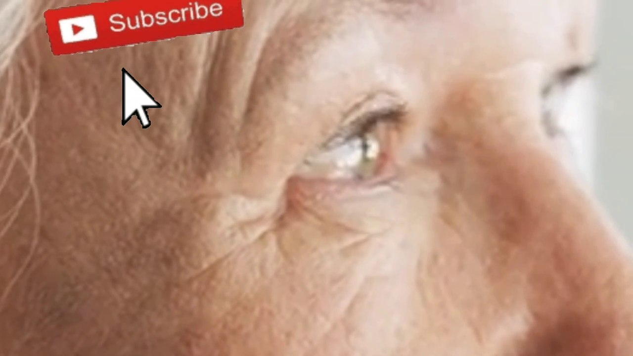 الزهايمر أعراضه و تجنبةDementia